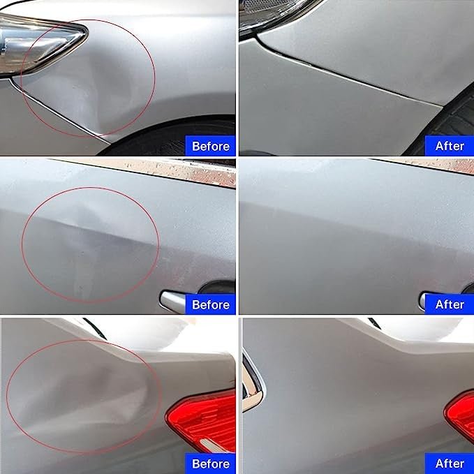 kit extrator plástico auto - Shopp Brasil